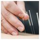 Dry Needling