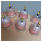 Cupping